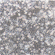 ECV-304人膀胱癌細(xì)胞