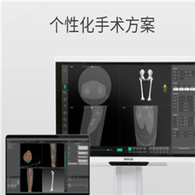 關節置換手術導航定位系統
