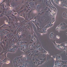 ˷ͷ״ٰϸ-820(ոȷ)