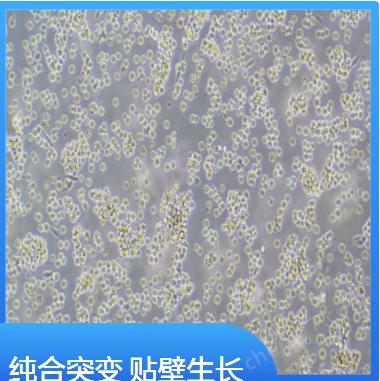 小B細胞淋巴瘤細胞STR鑒定A20+LUC+GFP