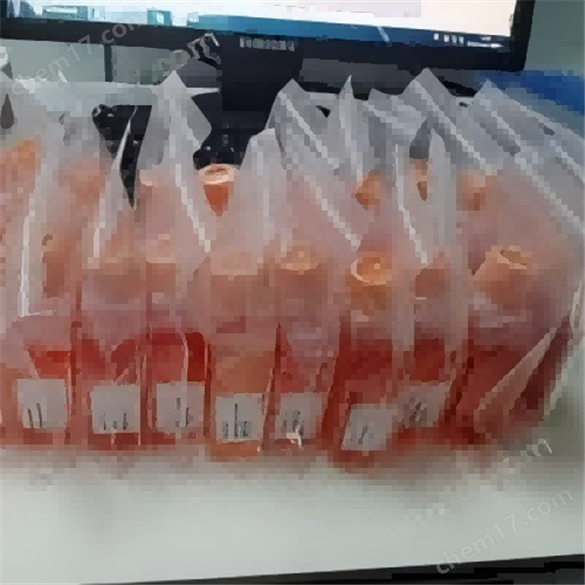 nci-H929人骨髓瘤細(xì)胞