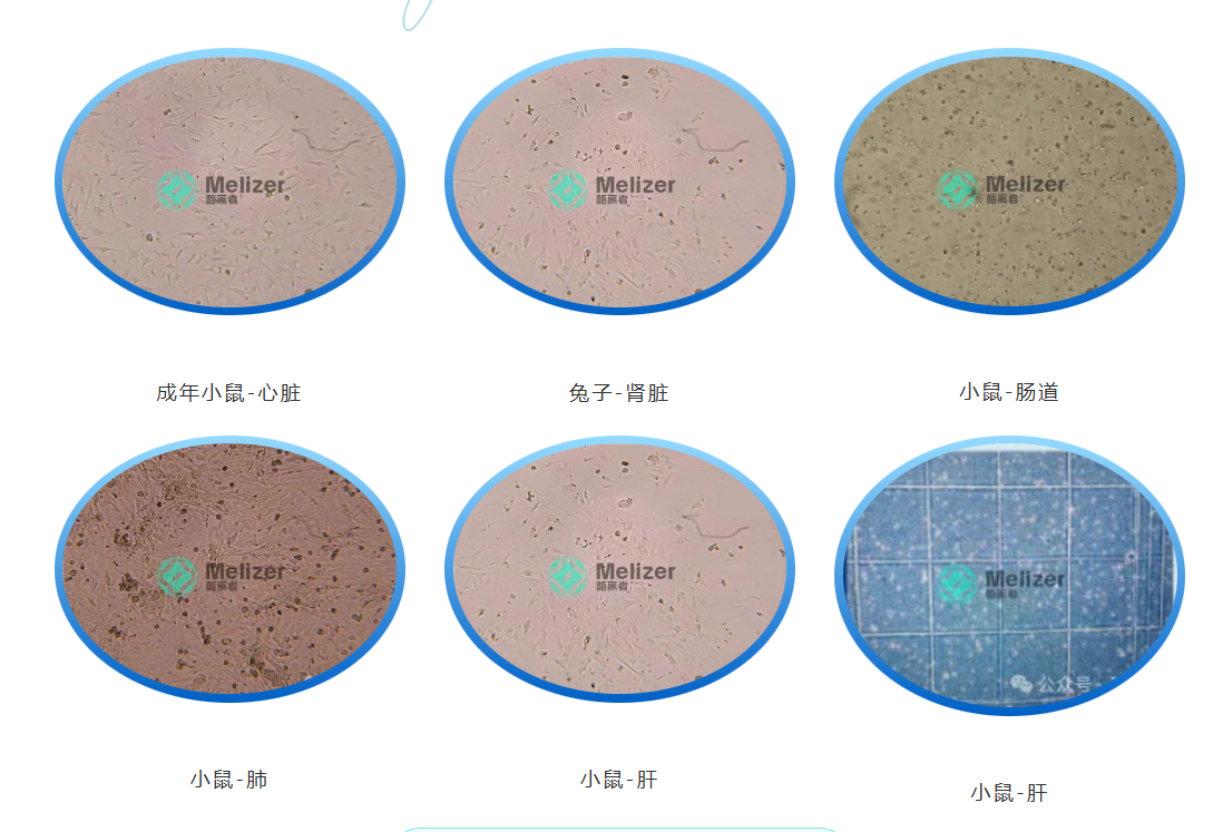 dce82b7dd9229ec217b01ef134dff356.png 解離酶