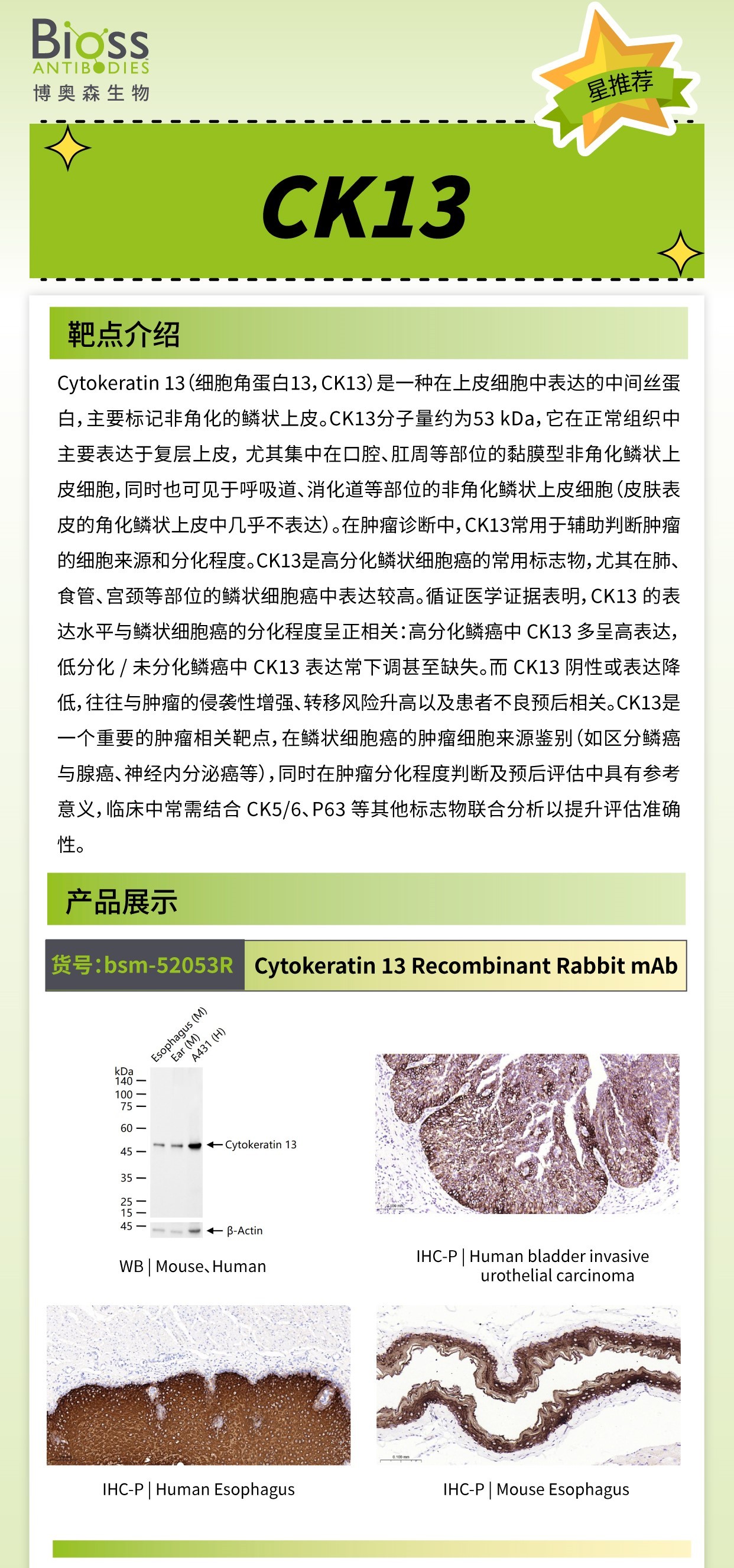 Bioss 星推荐 | CK1 抗体
