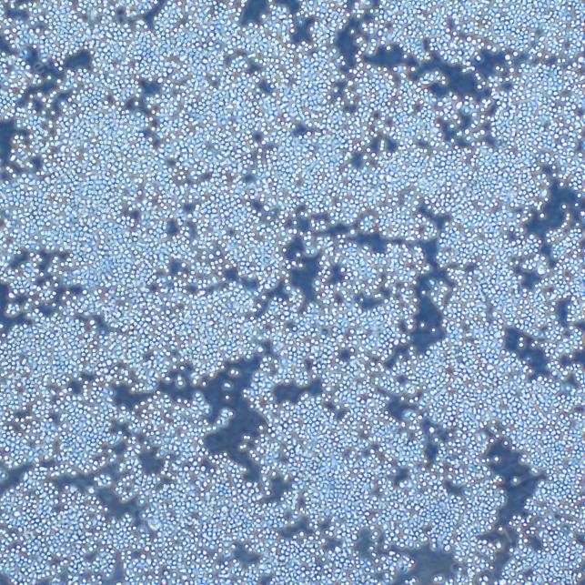 人胃癌細(xì)胞NUGC-4（STR鑒定正確）