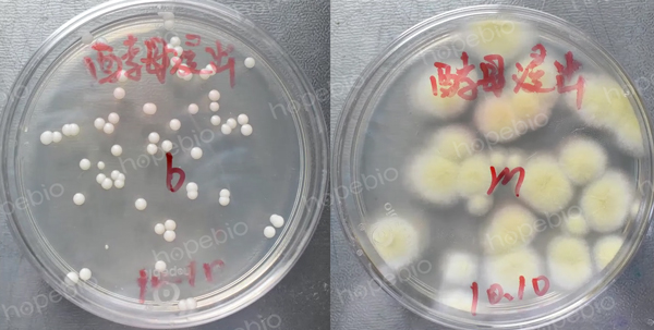 酵母浸出物葡萄糖土霉su琼脂培养基